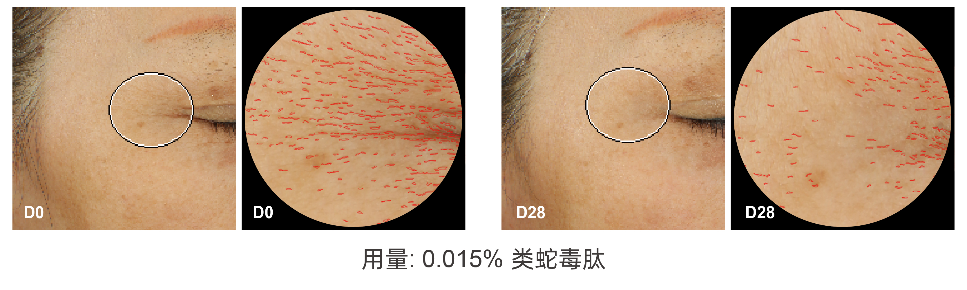 二肽二氨基丁酰苄基酰胺二乙酸盐 二肽二氨基丁酰苄基酰胺二乙酸盐