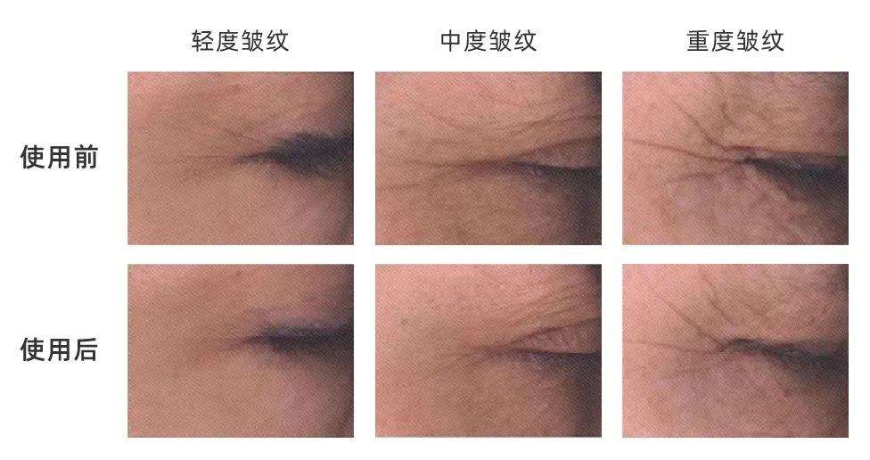 选对功效成分，和皱纹轻松Say No！