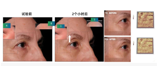 皱纹橡皮擦——芋螺毒素肽