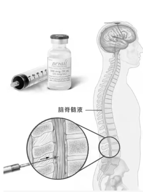 皱纹橡皮擦——芋螺毒素肽