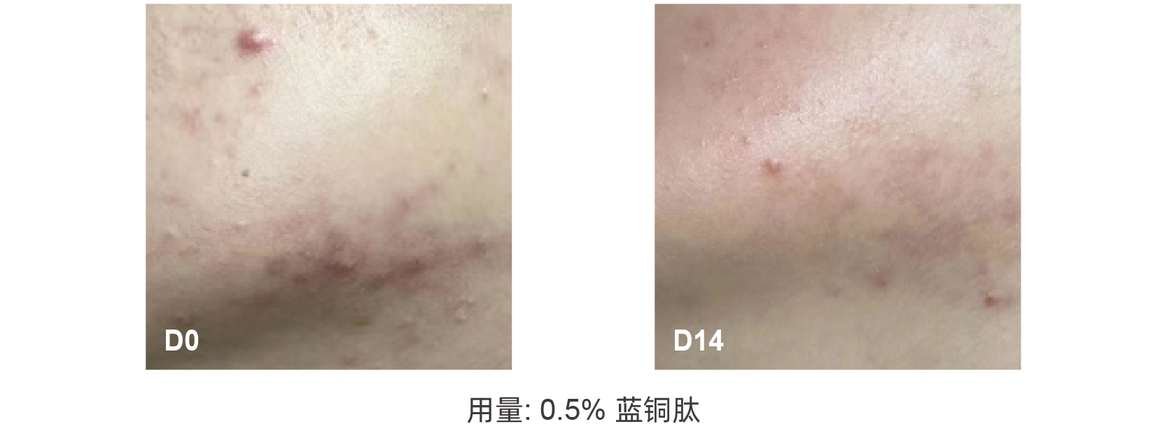 蓝铜肽 蓝铜肽