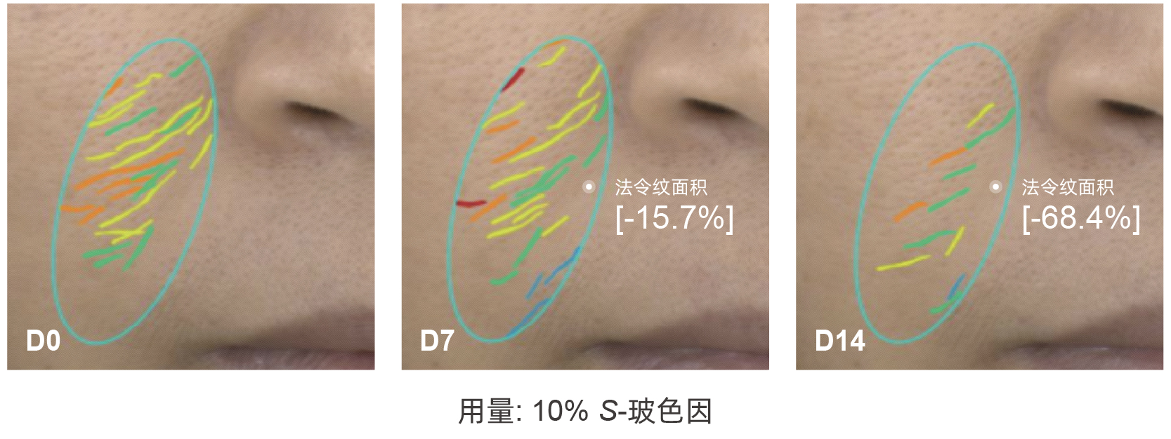 S-玻色因 S-玻色因