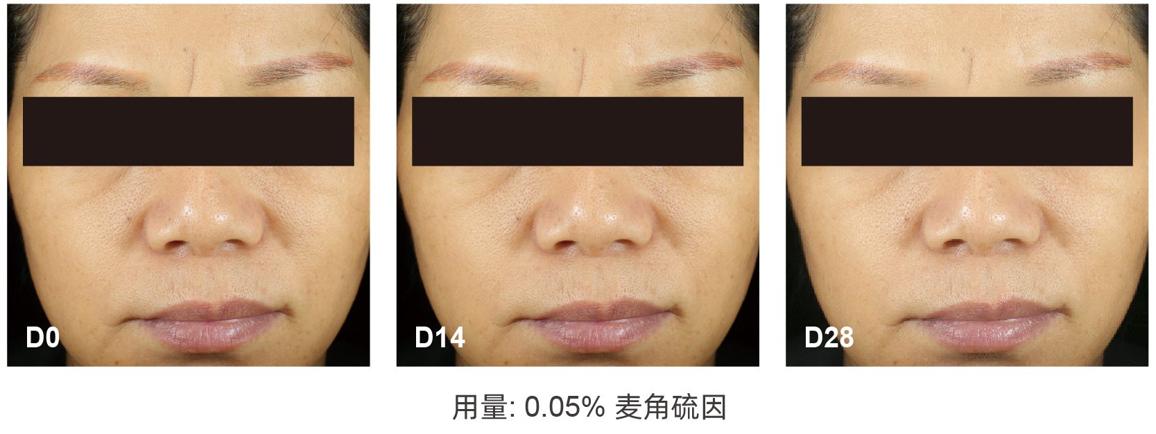 麦角硫因 麦角硫因
