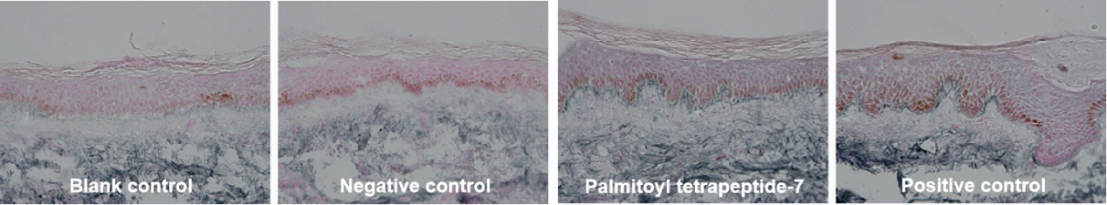 Palmitoyl tetrapeptide-7 Palmitoyl tetrapeptide-7