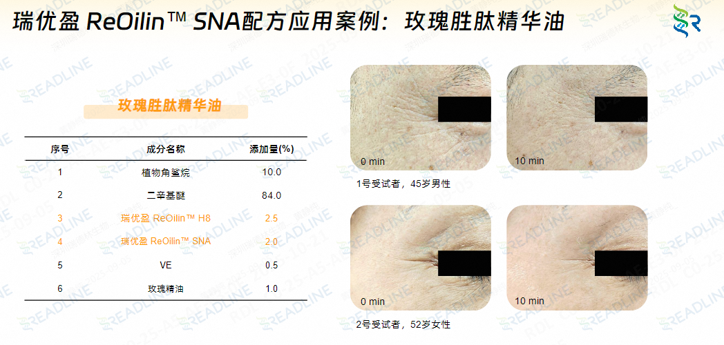 抗皱特长生报到!酶成品类蛇毒肽获国家发明专利授权 抗皱特长生报到!酶成品类蛇毒肽获国家发明专利授权
